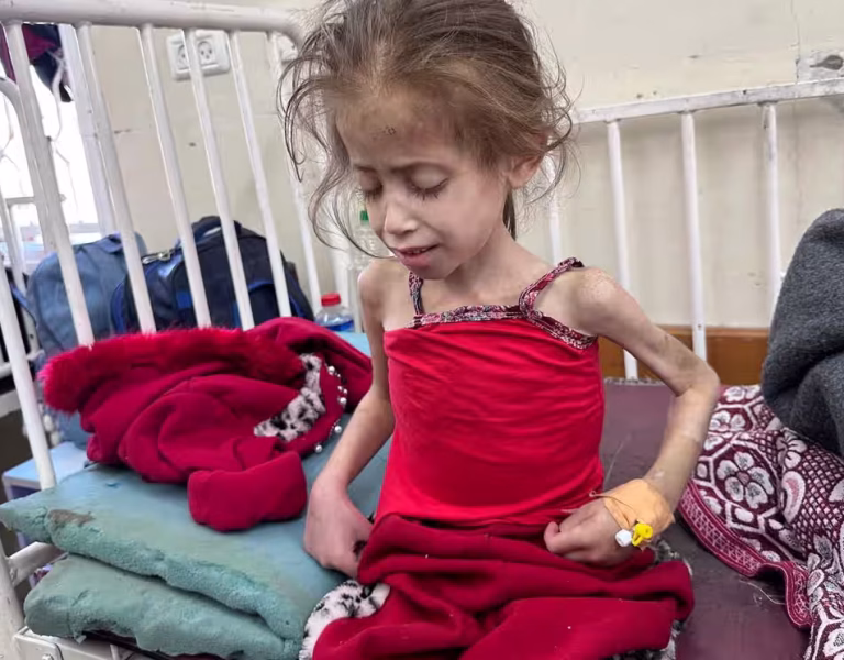 جهان باید برای توقف گرسنگی عمدی فلسطینی‌ها توسط اسرائیل اقدام کند