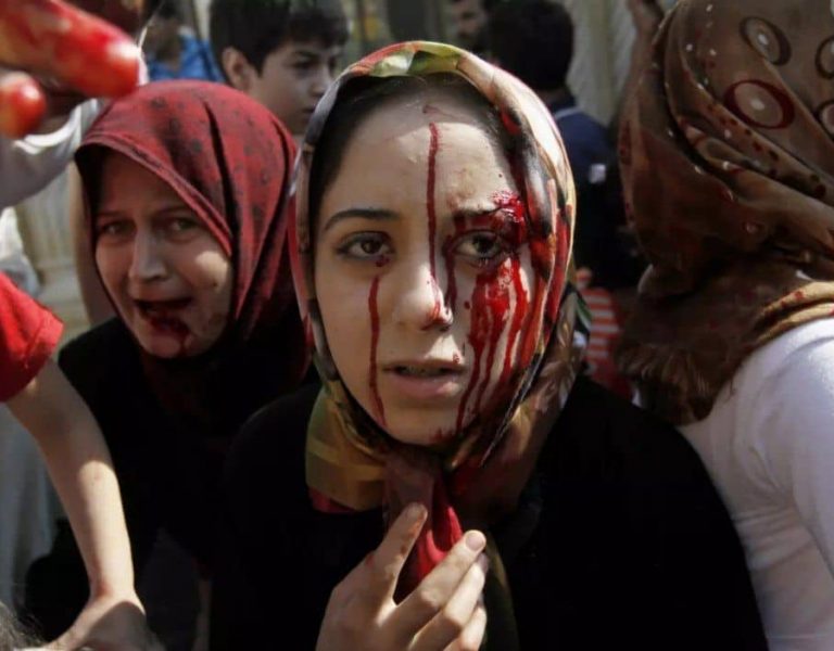 من یک بازمانده هستم؛ بازمانده حملات شیمیایی، جنگ، محاصره، آوارگی اجباری و خشونت جنسی